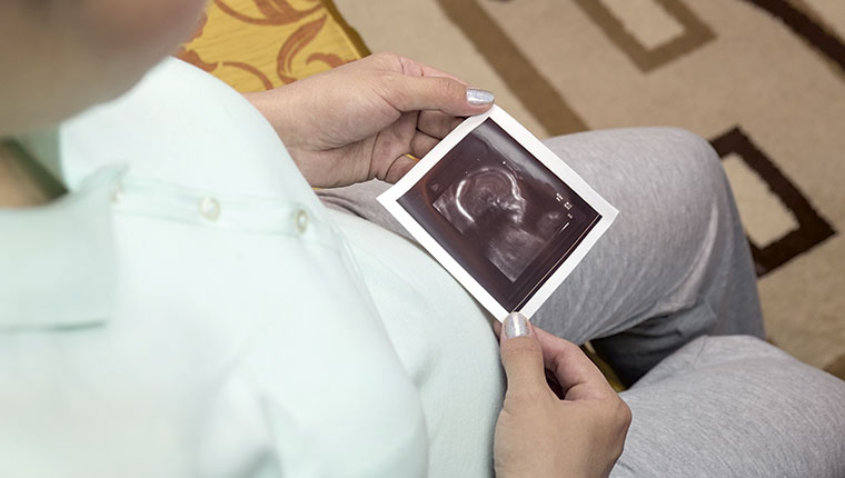 Gravid kvinde med ultralydsbillede